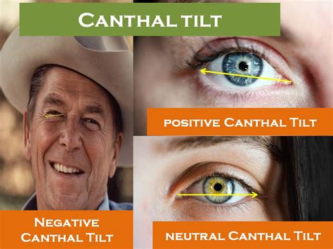 canthal tilt|what is positive canthal tilt.